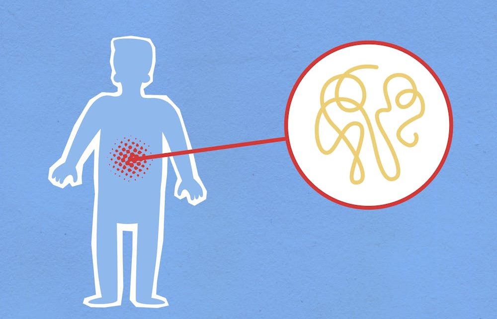 Les avantages des aliments fermentés pour la santé digestive